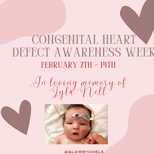 Fundraising Page: Chelsea Beyer